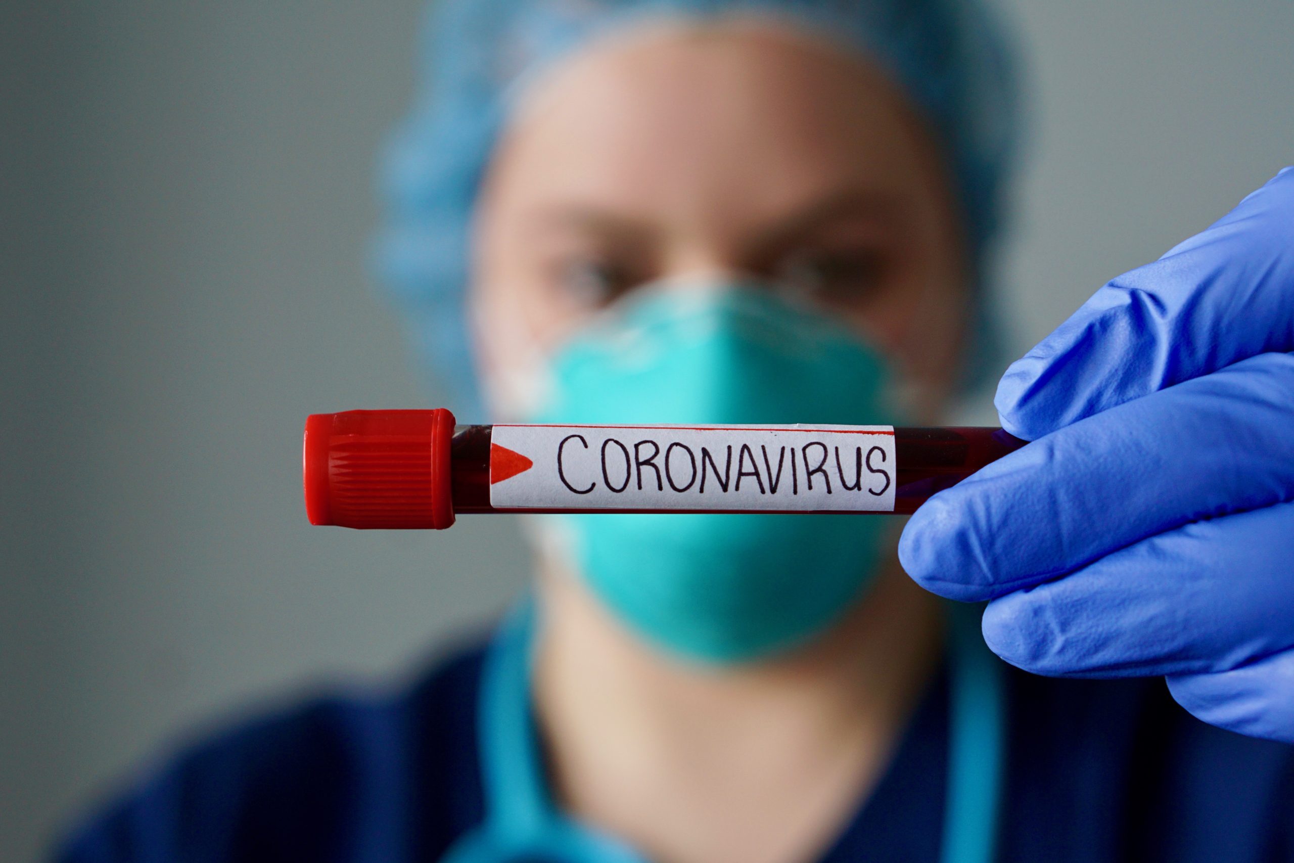 A Boa Notícia: jovem faz descoberta sobre covid-19