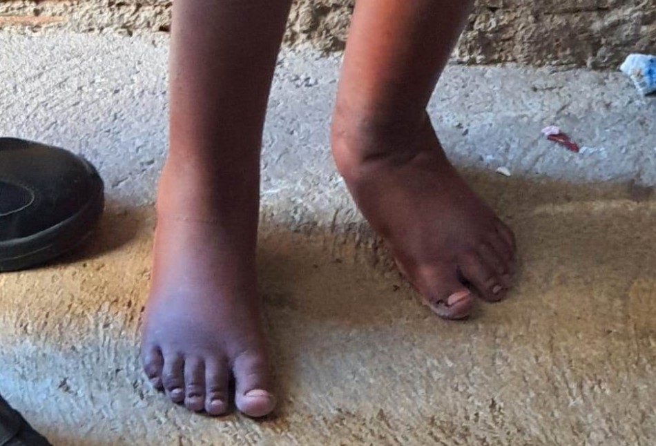 Psicóloga relata traumas para crianças maltratadas