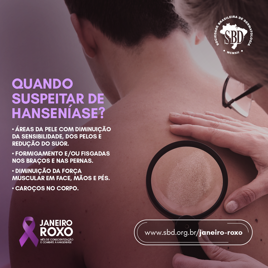 Hanseníase, a doença mais antiga do mundo, ainda é tabu no Brasil