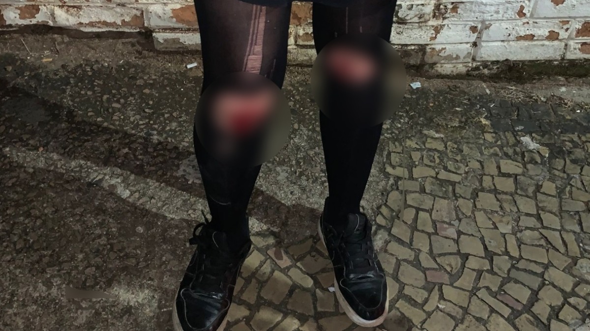 Mulher é arrastada por criminoso durante roubo em Campinas