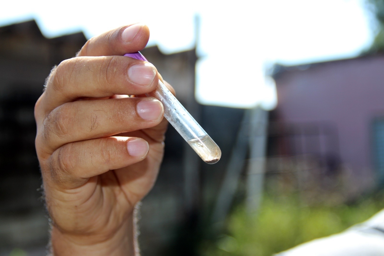 Campinas tem 4ª morte por dengue e cria grupo para agilizar vistoria de criadouros