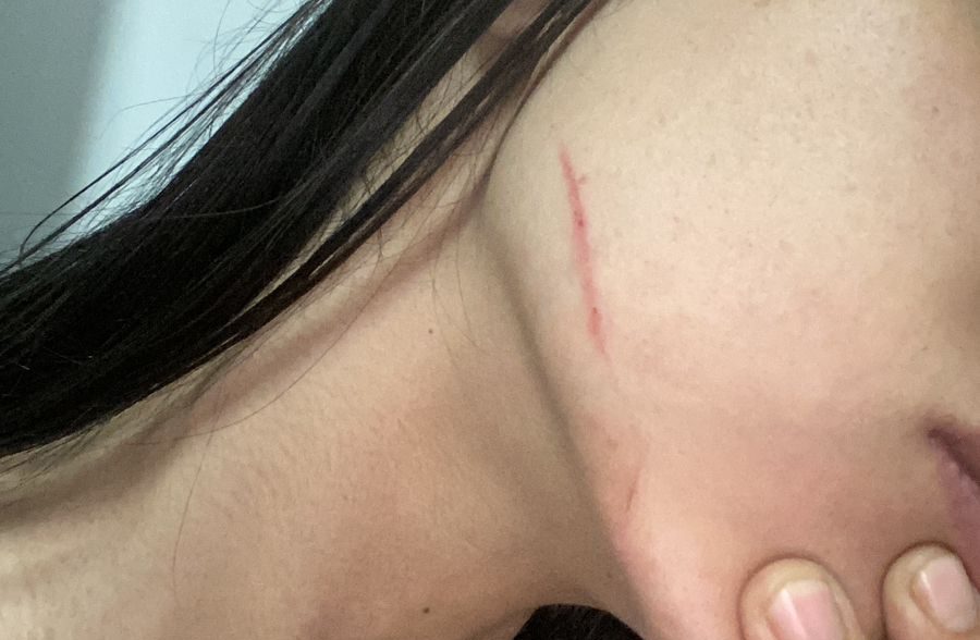 Comerciante é atacada com canivete e moradores pedem mais segurança no Bonfim