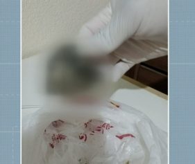 Pais afirmam que hospital esqueceu gaze dentro de criança após cirurgia