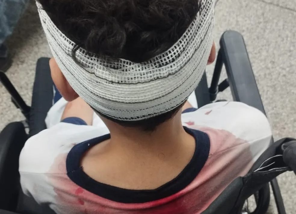 Menino é atropelado por motociclista que fugia da Guarda Municipal em Campinas