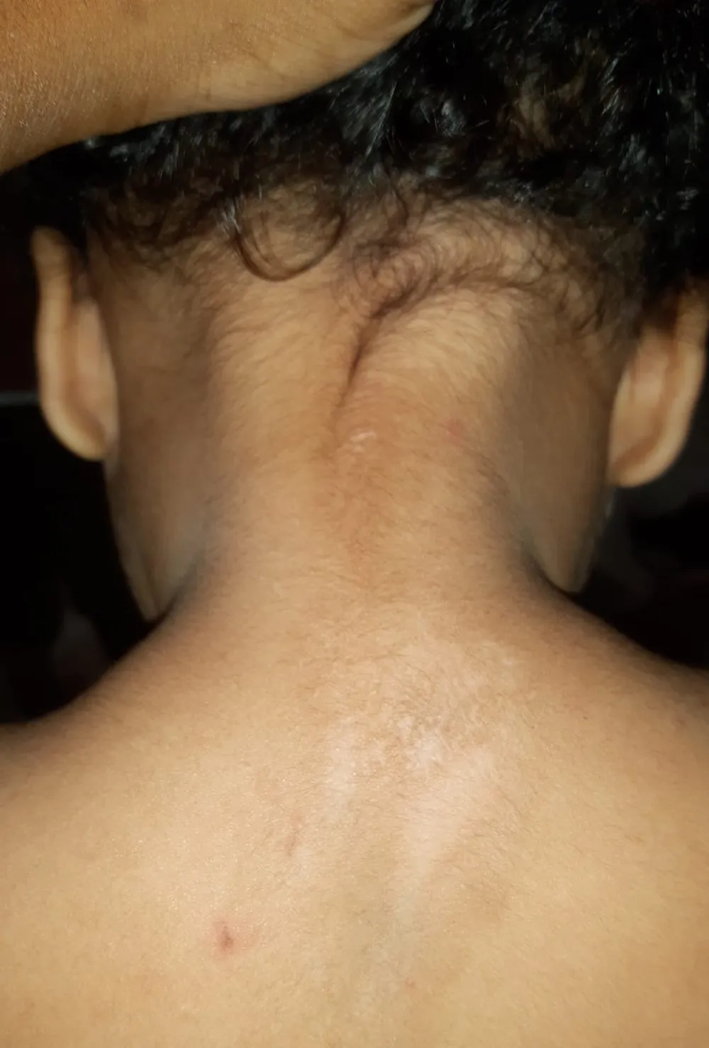 Família de bebê queimada na creche cobra respostas após três meses do caso