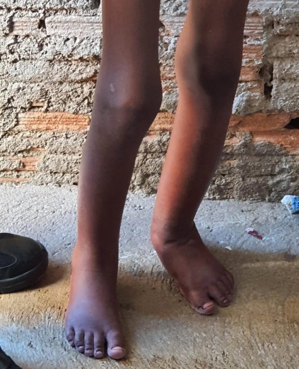 Criança resgatada acorrentada em barril é adotada