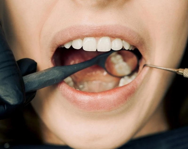 Além da vacina da gripe, Valinhos faz testes para prevenir câncer bucal