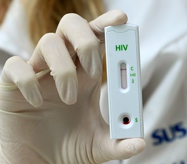 Campinas registra queda de 22% no número de infecções por HIV