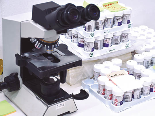 Estudo coordenado pela Unicamp antecipa diagnóstico do câncer de colo do útero até 10 anos