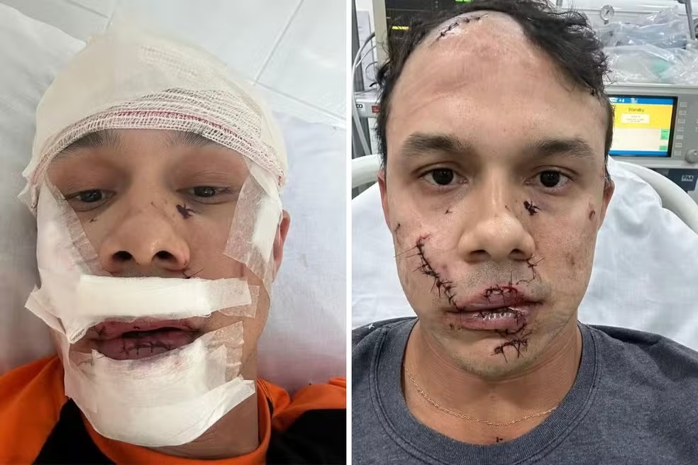 Personal trainer é agredido ao defender mulheres de assédio em bar de Águas de Lindóia