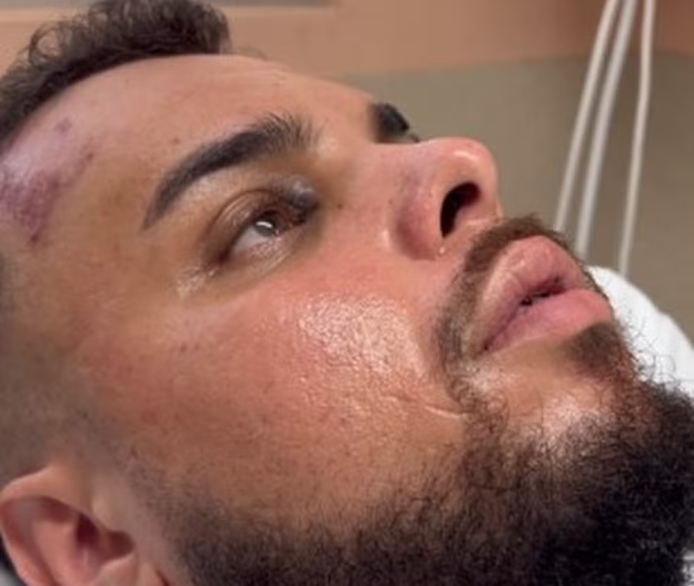 Família desmente que homem agredido no dérbi era infiltrado na torcida bugrina
