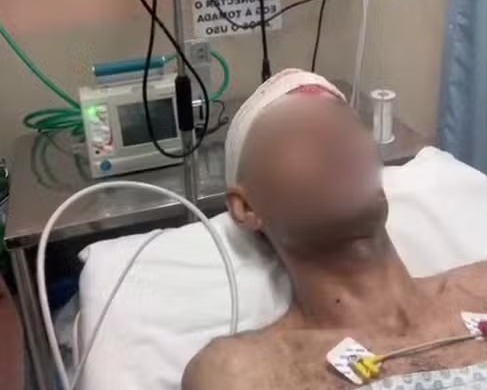 Homem baleado na cabeça em Campinas passa por cirurgia de sete horas e tem quadro estável 