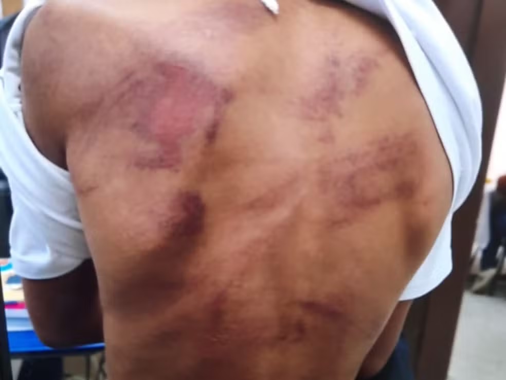 Pai é preso suspeito de agredir filho de 9 anos; criança tinha marcas de violência nas costas